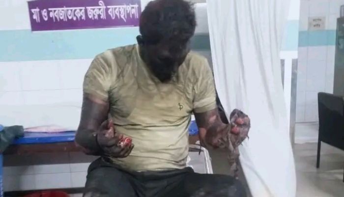 স্কুলবাসে অগ্নিসংযোগ, চালকের মৃত্যু