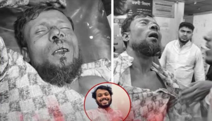 হাদির জন্য দোয়াকে কেন্দ্র করে শ্রমিক নেতার উপর হামলা-