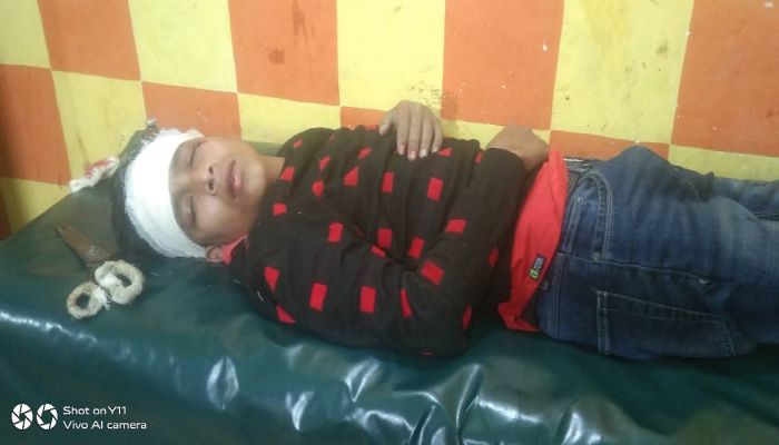 হাতীবান্ধায় মাদ্রাসার নাইট গার্ডের রডের আঘাতে অষ্টম শ্রেণির শিক্ষার্থী গুরুতর আহত