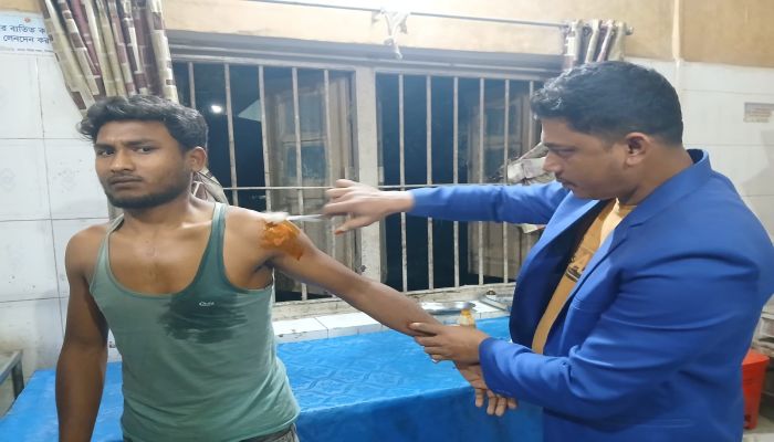 নীলফামারীতে কুকুরের কামড়ে শিশুসহ আহত ১৪, ভ্যাকসিন সংকটে ভোগান্তি