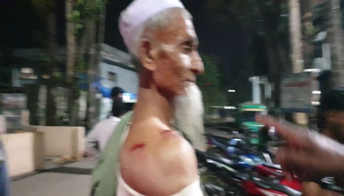 মৌলভীবাজারে দুর্বিত্তদের হাতে বৃদ্ধ আলেম আহত হওয়ার ঘটনায় মামলা, প্রতিবাদে আলেমদের মানববন্ধন 