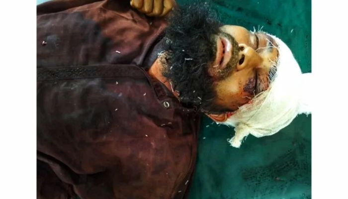 ফেনীতে যাত্রীবেশে উঠে চালককে কুপিয়ে অটোরিকশা ছিনতাই, চিকিৎসাধীন অবস্থায় মৃত্য
